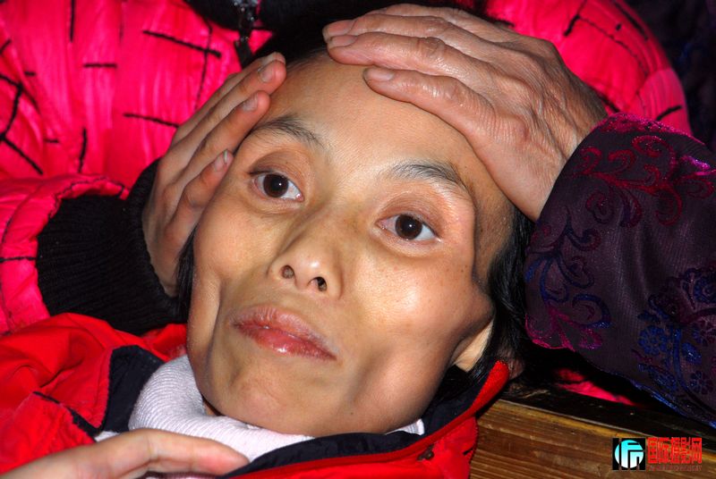 谭慧蓉在病榻前睁着明亮的大眼睛从容面对死神的到来